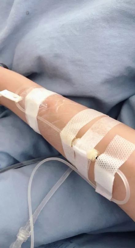 女生输液照片请假专用